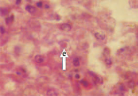 Fig. 3. Eosinophilic inclusion bodies
are encountered significantly less
frequently, have a round or irregular
shape and are surrounded by a light
halo (arrow – e). H/E, Bar = 10 µm.