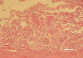 Fig. 1. Haemorrhagic desquamative
catarrh of the mucosa in a 10-weekold
turkey. H/E, Bar = 50 µm.
