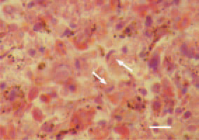 Fig. 2. A characteristic diagnostic
finding is the detection of large, acidophilic,
rarely basophilic intranuclear
inclusion bodies in the reticuloendothelial
cells of the spleen (arrows).
The displaced condensed nuclear
chromatin around the inclusion bodies
often resembles a crescent. H/E,
Bar = 10 µm.