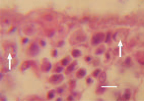 Fig. 3. Sometimes, similar inclusion
bodies could be detected in the lamina
propria of the intestinal mucosa
(arrows). H/E, Bar = 10 µm.