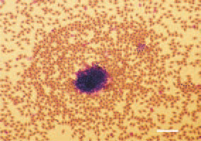 Fig. 5. The stained peripheral blood
smears exhibit the typical picture of a
septicaemia. H/E, Bar = 10 µm.