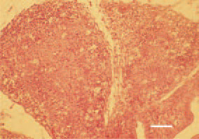 Fig. 1. Almost complete disappearance
of the normal follicular structure
of B. Fabricii, resulting from severe
degenerative necrobiotic lesions
and inflammatory cell infiltration.
H/E, Bar = 70 µm.