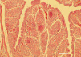 Fig. 2. Marked interfollicular inflammatory
oedema, haemorrhages and
inflammatory necrotic lesions in the
medullary zone of bursal follicles.
H/E, Bar = 100 µm.