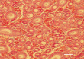 Fig. 2. Inflammatory hyperaemia, oedema
and haemorrhages in kidneys,
due to nephrotropic IB strains. H/E,
Bar = 40 µm.