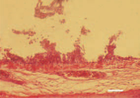Fig. 1. Trachea, a transverse crosssection.
Severe haemorrhagic desquamative
inflammation of the mucous
coat. Erosions, ulcers and a extremely
thinned mucous layer. H/E, Bar = 50
µm.