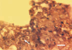 Fig. 2. The detection of eosinophilic
intranuclear inclusion bodies (arrow),
surrounded by a light halo in the mucous
coat epithelium is of essential
diagnostic value. This is possible in
the initial stage of the disease, prior
to the occurrence of desquamative
lesions. H/E, Bar = 10 µm.