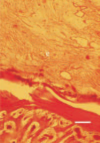 Fig. 1. Subcutaneous mucinous oedema (e) in the region
of the head in a broiler chicken. H/E, Bar = 70
µm.