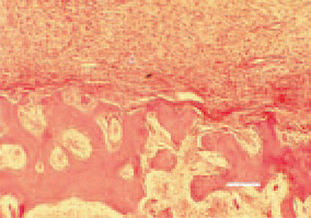 Fig. 2. Subcutaneous inflammatory
cell oedema (ic) in the region of the
head in a female broiler breeder, 33
weeks of age, H/E, Bar = 35 µm.