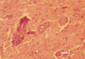 Fig. 1. The histological lesions are
specific and have a diagnostic value.
A non-purulent encephalomyelitis
with noticeable perivascular clusters
are present. H/E, Bar = 25 µm.