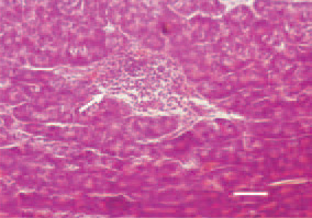 Fig. 4. Other important diagnostic
findings are the dense lymphoid aggregates
in the musculature of the
proventriculus and the gizzard, as
well as in the pancreatic interstitium
(arrow). H/E, Bar = 40 µm. 