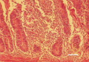 Fig. 1. Diffuse inflammatory cell proliferate
in small intestinal mucous
coat. Chickens at the age of 5 - 12
days are affected. Etiologically, reoviruses,
astroviruses and rotaviruses, individually
or collectively, are involved.
The possible vector of infection are
the larvae of the lesser mealworm
beetle Alphitobius diaperinus. H/E,
Bar = 100 µm.