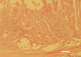 Fig. 5. Inflammatory proliferative and
cystic lesions in the mucous coat of
the proventriculus. H/E, Bar = 100
µm.