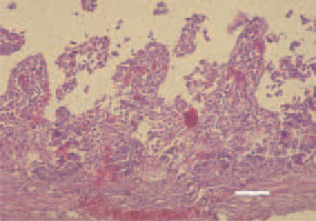 Fig. 1. Poult enteritis mortality syndrome
(PEMS) is an infective, transmissible
multifactorial disease, affecting
turkey poults at the age of 1–4
weeks. It is characterized with diarrhoea,
dehydratation and increased
mortality. Histologically, target cells
are those of intestinal mucous coat
epithelium. An acute enterotyphlitis
with villous atrophy is present. H/E,
Bar = 50 µm.