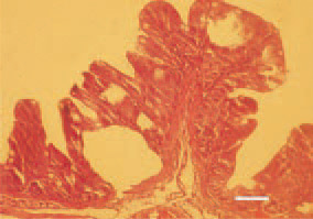 Fig. 3. The intestinal lumen is filled
with watery fluid and gas. Sometimes,
glandular crypts are transformed
into cystic cavities. H/E, Bar
= 30 µm.