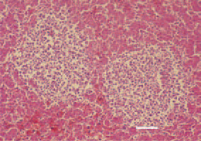 Fig. 1. Symmetrical neoplastic foci of
pleomorphic cells, liver, hen. H/E, Bar
= 50 µm.