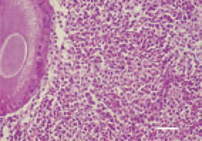 Fig. 6. Pleomorphic cell proliferation,
ovary, hen. H/E, Bar = 25 µm.