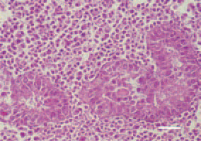 Fig. 7. Intertubular, pleomorphic cell
proliferation, testis, cock. H/E, Bar =
30 µm.