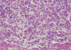 Fig. 4. Lymphoid leukosis, spleen,
hen. Growth of large lymphoid cells
of a slightly varying size. H/E, Bar =
25 µm.