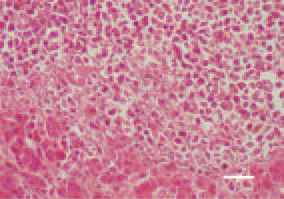 Fig. 5. Liver, lymphoid leukosis, hen.
Focal growth of lymphoblasts, single
lymphocytes, resulting in atrophy of
the parenchyma. H/E, Bar = 25 µm.