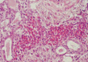 Fig. 3. Focal intertubular myelocyte
proliferations in the kidney. H/E, Bar
= 25 µm.