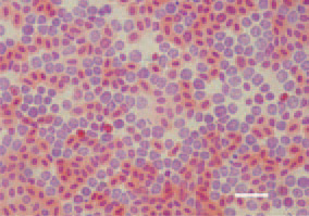 Fig. 4. Numerous myelocytes in the
peripheral blood of a guineafowl
keet, 95 days after challenge with
an ALV-J isolate. H/E, Bar = 10 µm.