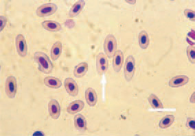 Fig. 5. Blood smear from a hen with
myelocytomatosis. A picture of anaemia
– anisocytosis, poikilocytosis,
two-nucleus erythrocyte (arrow).
H/E, Bar = 10 µm.