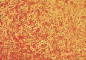 Fig. 13. Myxosarcoma, liver, hen. H/E,
Bar = 25 µm.