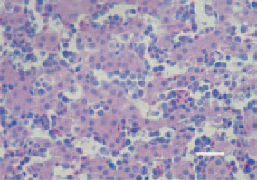 Fig. 1. Tissue cross-section, liver. Erythroblastosis
is characterized by intravascular
proliferations of immature
precursors of erythrocytes. Histologically,
accumulation of erythroblasts
in blood sinusoids and capillaries is
observed. H/E, Bar = 25 µm.