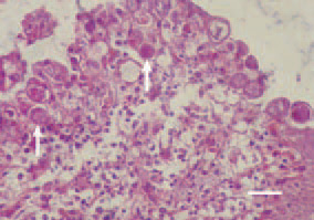 Fig. 1. Histologically, developmental
forms (arrows) in a different stage
of Eimeria life cycle are detected in
epithelial cells of intestines. H/E, Bar
= 25 µm.