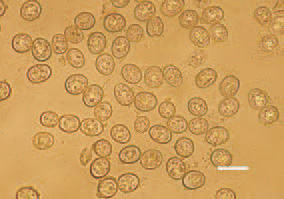 Fig. 2. The microscopic examination
of a native preparation of intestinal
content or of superficial mucosal layer
reveals numerous oocysts in one
observation field, native preparation,
Bar = 10 µm.