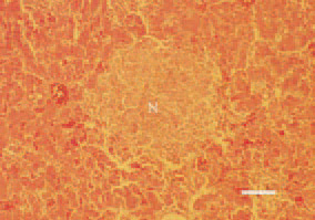 Fig. 1. Histomoniasis, liver, turkey
poult. Coagulative necrotic foci (N),
haemorrhagically demarcated from
the adjacent liver parenchyma. H/E,
Bar = 40 µm.
