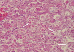 Fig. 2. Multiple oval-shaped histomonads
(arrows) in a liver tissue
cross-section, pheasant. H/E, Bar =
25 µm.