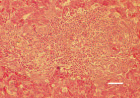 Fig. 4. Regenerative reparative processes
at a later stage of the organization
of a hepatic necrotic focus
in a turkey poult. Histomonas forms
(arrows) are still visible. H/E, Bar = 40
µm.