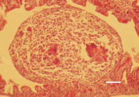 Fig. 3. Aspergillus granuloma to the
highly corrugated mucosa of a parabronchus,
lung, chicken. H/E, Bar =
25 µm.