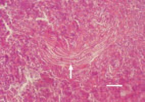 Fig. 4. Aspergillosis, liver, chicken.
Aspergillus mycelium outgrowth (arrow).
H/E, Bar = 50 µm.