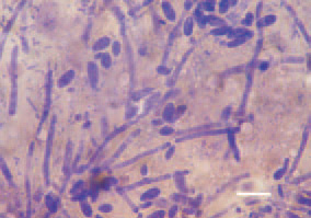 Fig. 3. Pseudohyphae and chlamydospores.
Candidosis, touch imprint
prepratation, crop, turkey broiler.
Diff Quik, Bar = 10 µm.