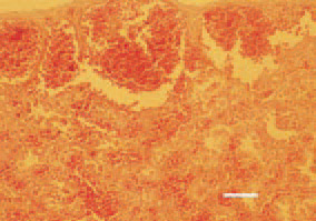 Fig. 1. In some fusariotoxicoses, common
findings in the liver are the massive
subcapsular haematomas, causing
sudden death in broiler chickens.