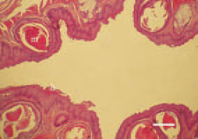 Fig. 1. Transverse cross-section of the
oesophagus, hen. In some instances,
miliary grey-whitish thick nodules,
prominating over the surface of the
buccal mucosa, the oesophagus and
the crop, could be observed. They
are result of the occurring hyperkeratinization
(h) and metaplasia (m) of
the glandular epithelium. H/E, Bar =
35 µm.