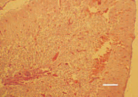 Fig. 3. Haemorrhages and multiple
thrombosed blood vessels in the cerebelum.
H/E, Bar = 100 µm.