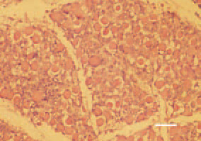 Fig. 5. Late stage of muscular dystrophy,
thigh muscle, chicken. Marked
acidophilia of muscle cells and beginning
of regenerative reparative processes,
organization. H/E, Bar = 35
µm.