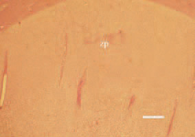 Fig. 1. Histopathological lesions in
rickets due to calcium and vitamin D
deficiency. The proliferative zone of
the growth plate is widened, irregular
and poorly vascularized. Only a
small zone of hypertrophic cartilage
and reduced calcification is present.
H/E, Bar = 40 µm.