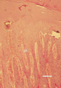 Fig. 2. Histopathological lesions in rickets due to phosphate
deficiency or excessive calcium levels. The hypertrophic
zone (zh) of the growth plate is increased,
noncalcified, but normally vascularized by metaphyseal
blood vessels. H/E, Bar = 40 µm. 