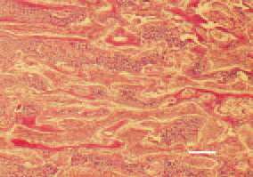 Fig. 3. A hypertrophic zone, consisting
of multiple nonmineralized trabeculae
of cartilage in a case of vitamin
D deficiency. H/E, Bar = 35 µm.