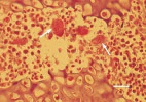Fig. 6. The detection of osteoclasts
(arrows) in some cases of calcium
deficiency rickets resembles the findings
in osteoporosis of laying hens.
H/E, Bar = 25 µm.