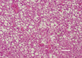 Fig. 1. Marked fatty dystrophy, vacuoles
of a various size in hepatocytes
and haemorrhages in the liver of a
laying hen. H/E, Bar = 30 µm.
