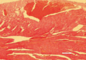 Fig. 1. Separation of intermyocardial
fibres by a moderate to extensive
oedema of loose connective tissue.
Subepicardial and myocardial haemorrhages
of a various size. H/E, Bar
= 50 µm.