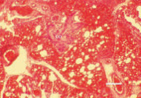 Fig. 2. Lung. Hyperaemia, haemorrhages
and oedema. A possible finding
is the appearance of of bone and
cartilage foci (co) among the pulmonary
parenchyma. H/E, Bar = 30 µm.
