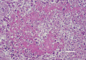 Fig. 1. Nodular form of amyloidosis,
marble spleen disease, pheasant.
Deposits of homogeneous amyloid
masses (a) from the periphery toward
the centre of white pulp follicles (f).
Congo red, Bar = 25 µm.