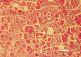 Fig. 2. Histologically, the altered
muscle fibres appear enlarged at a
various extent, distinctly eosinophilic
with rhexic or absent nuclei. H/E, Bar
= 40 µm.