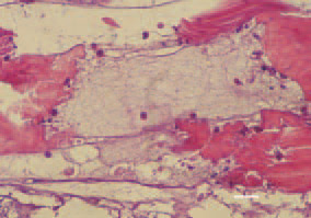 Fig. 4. Mucoid degeneration and a
distinct border between the affected
and intact muscle tissue areas. H/Е,
bar = 35 µm.